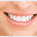 Free Smile Bright Teeth Whitening Strips from Savemore!